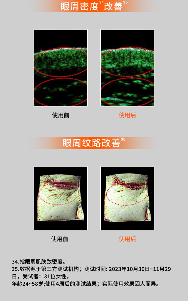 尊龙凯时(中国)人生就是搏人参眼霜